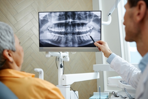 Reconstrucción Bucal Completa en Ontario, CA | Mini Implantes Dentales