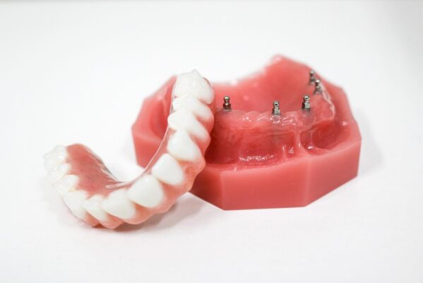 Mini Implant Dentures in Ontario, CA | Book a Free Consultation!