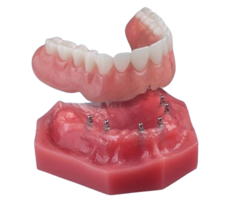 Denture Stability in Ontario, CA | Ask Us About Mini Dental Implants