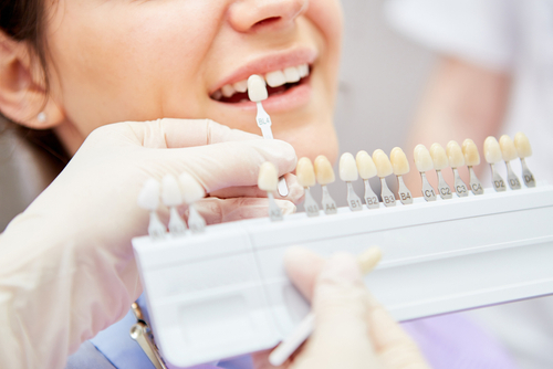 Tetracycline Teeth Stain | Skilled Cosmetic Dentist in Ontario, CA