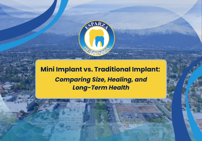 Mini Implant Solutions in Ontario, CA | Book a Free Consultation