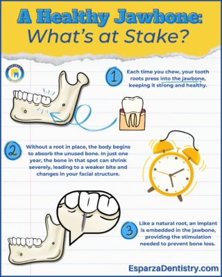 Dental Implants in Chino, CA | The Progression of Bone Loss