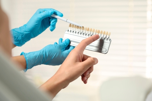 ¿Duele la colocación de carillas? | Dentista estético a precios accesibles en Ontario, CA