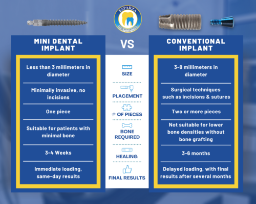 Implantes dentales mínimamente invasivos en Ontario | Miniimplantes frente a implantes convencionales